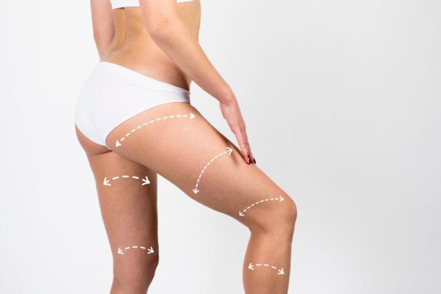 bodysculpt